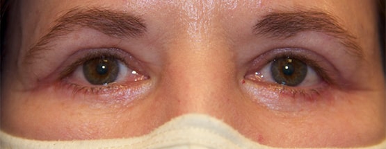 after image